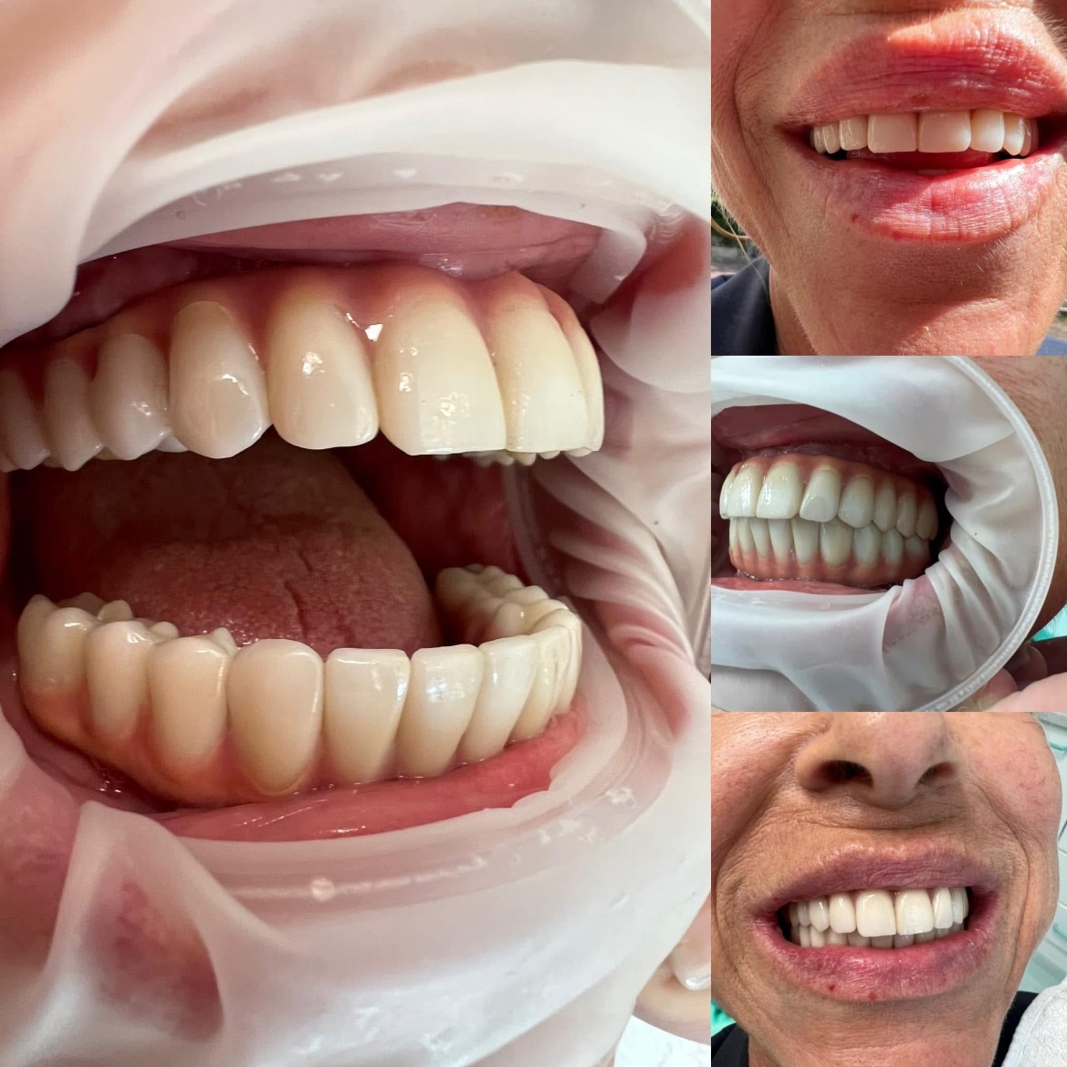 Galleria dei trattamenti