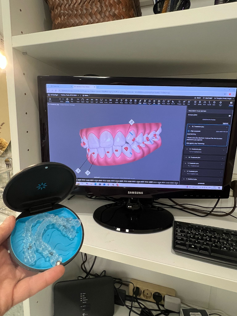 Ortodontska terapija: Više od estetike – put do zdravog i pravilnog zagriza