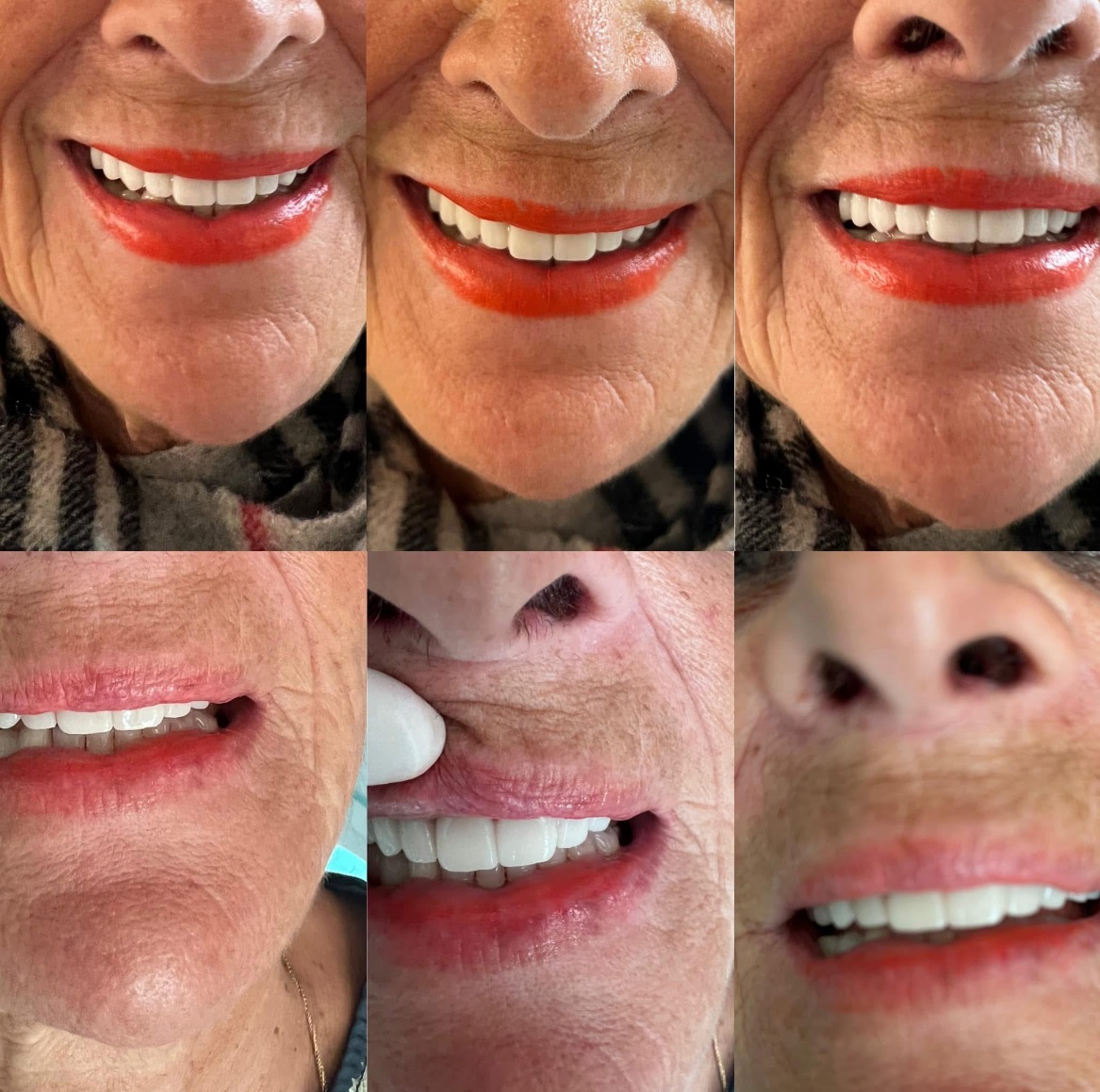 Galleria dei trattamenti