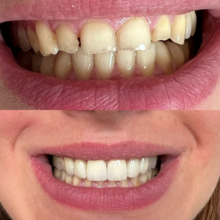 Galleria dei trattamenti