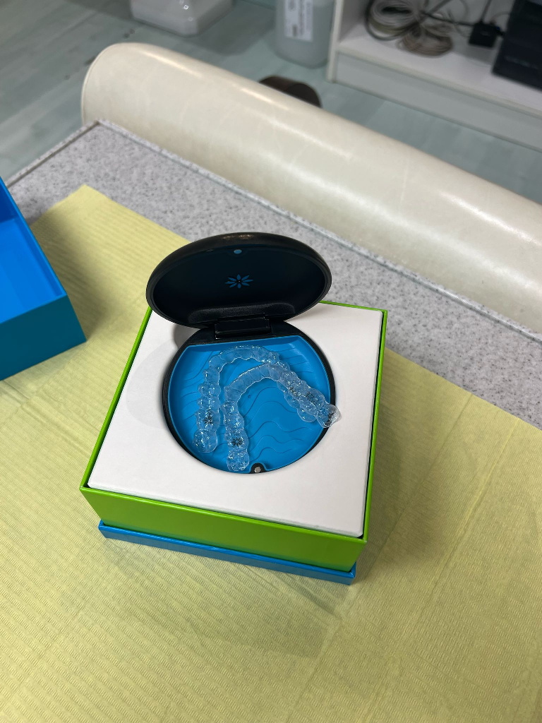 Ortodontska terapija: Više od estetike – put do zdravog i pravilnog zagriza