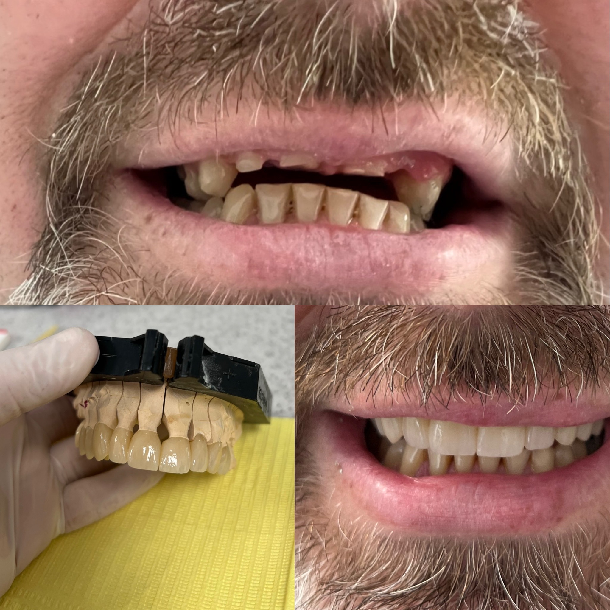 Galleria dei trattamenti