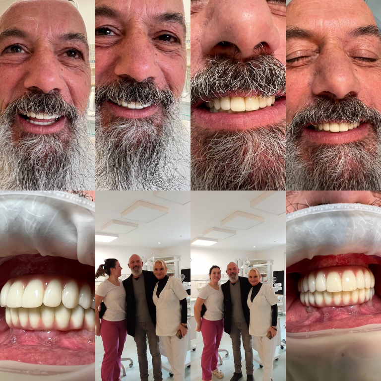 Galleria dei trattamenti