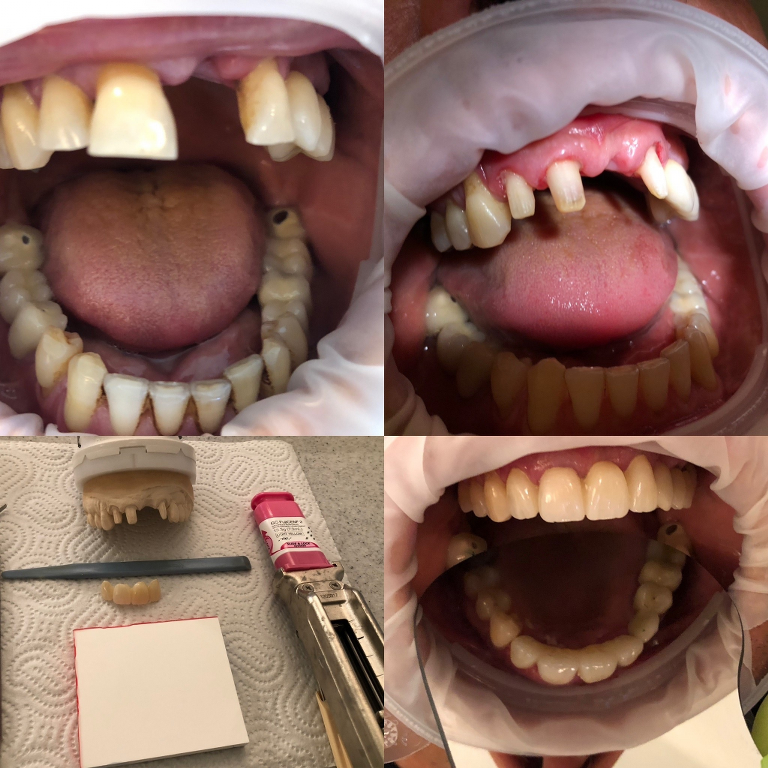 Galleria dei trattamenti